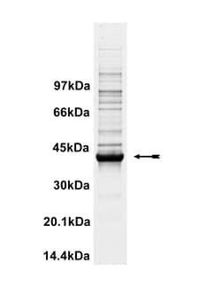 Eurofins DiscoverX LIM Kinase 1 Protein, Unactive 250 &mu;g | Buy Online | Eurofins DiscoverX | Fisher Scientific